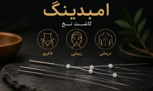 امبدینگ